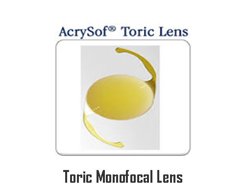 Toric Monofocal Lens 